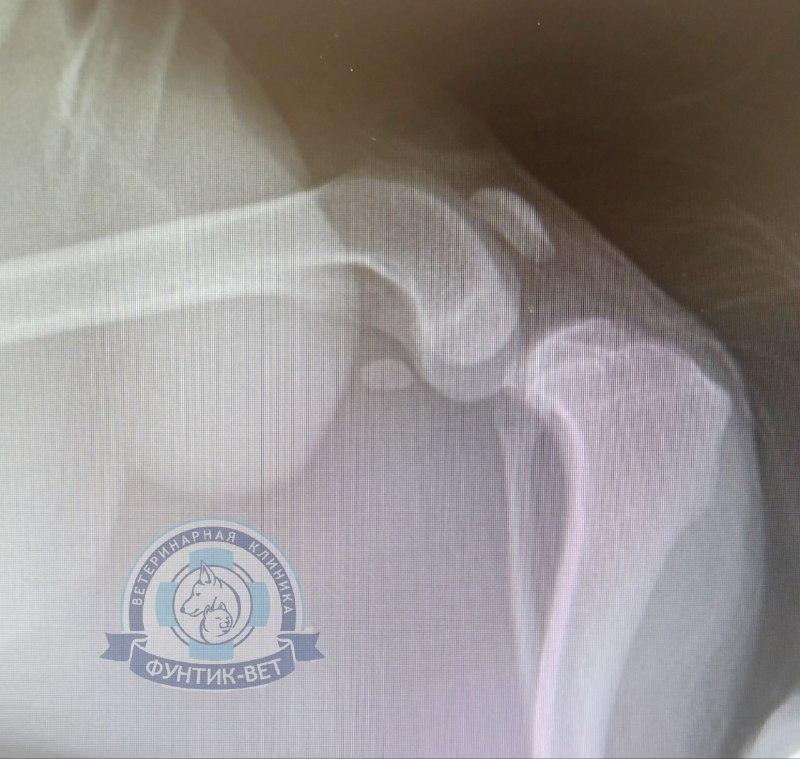 Разрыв ПКС Разрыв ПКС